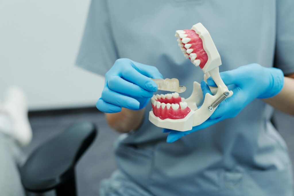 Impianti dentali e protesi: cosa c’è da sapere