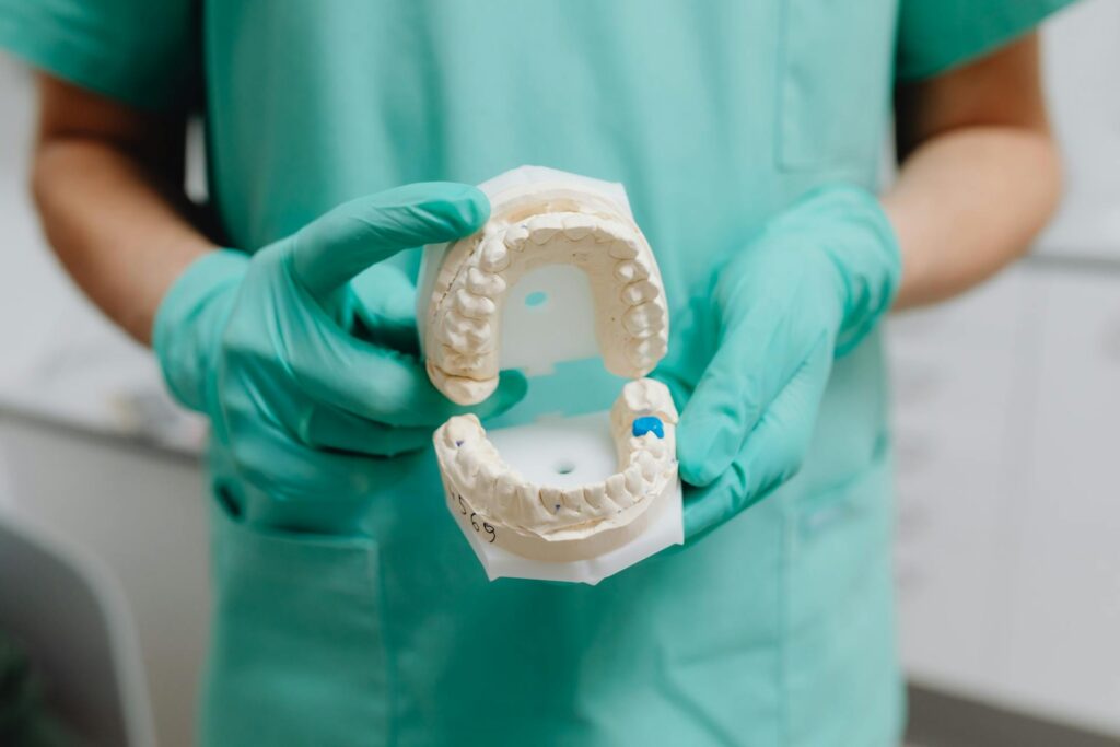 Perimplantite: quando l’impianto dentale provoca infezione