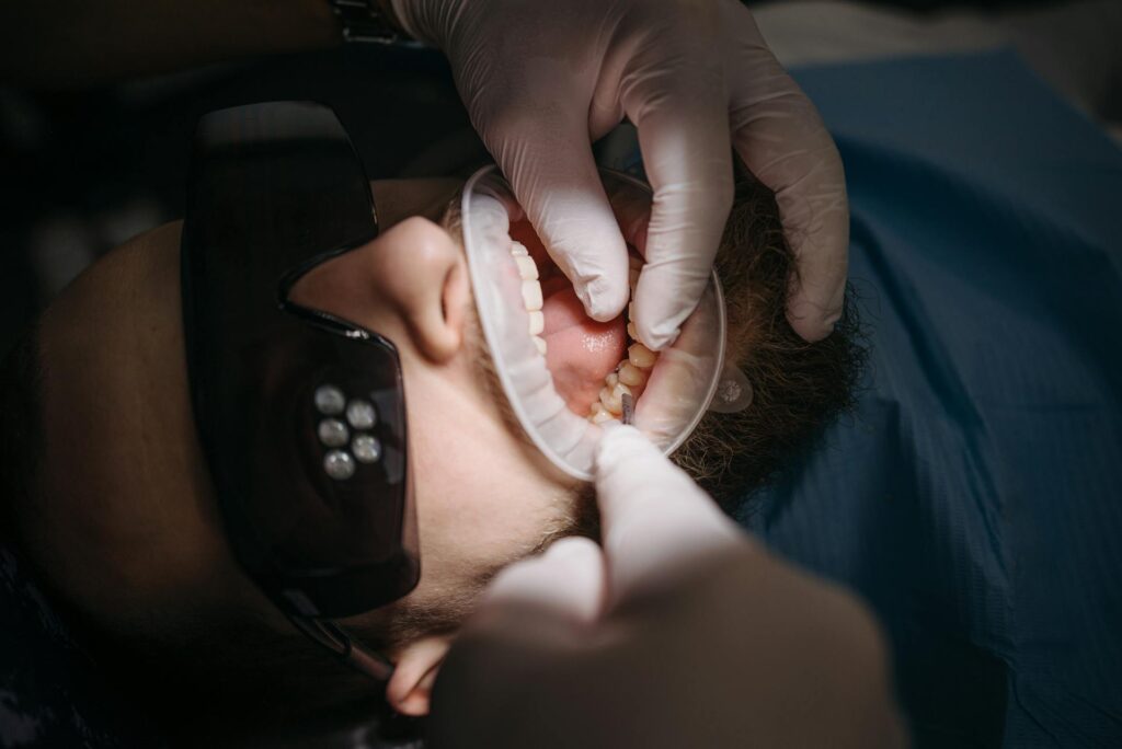 Impianti in titanio, la scelta più giusta secondo il miglior dentista di Latina