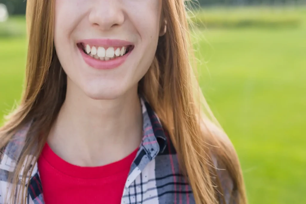 Sbiancamento dei denti rapido e indolore