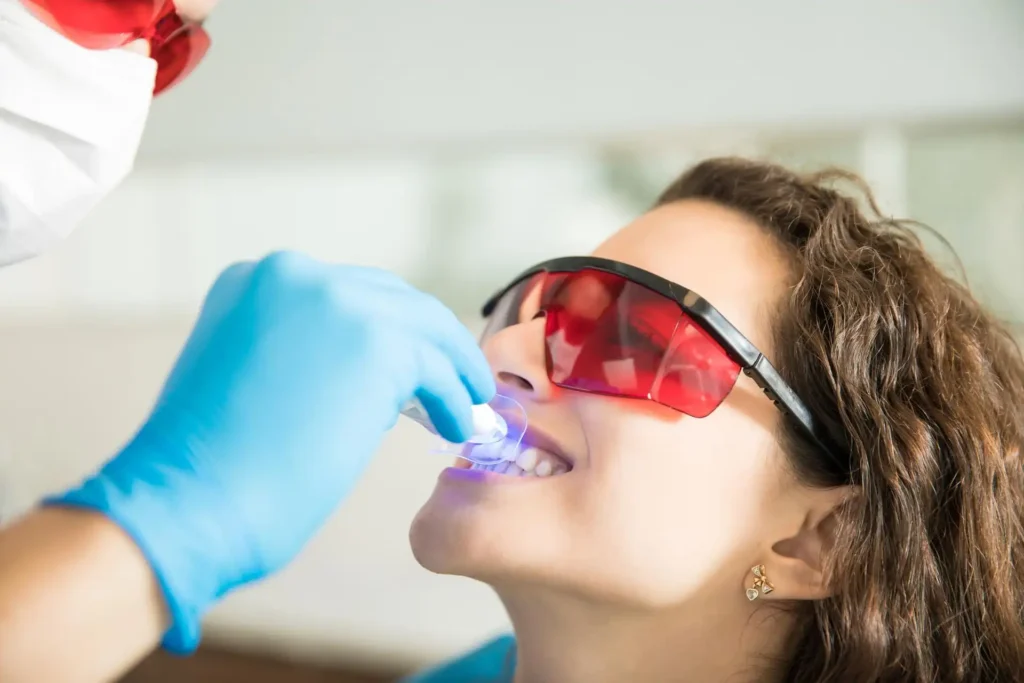 Usare i led per sbiancare i denti