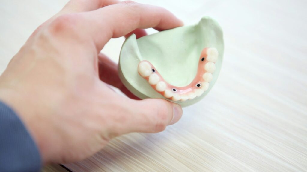 Ortodonzia invisibile: prendersi cura dei denti in modo discreto