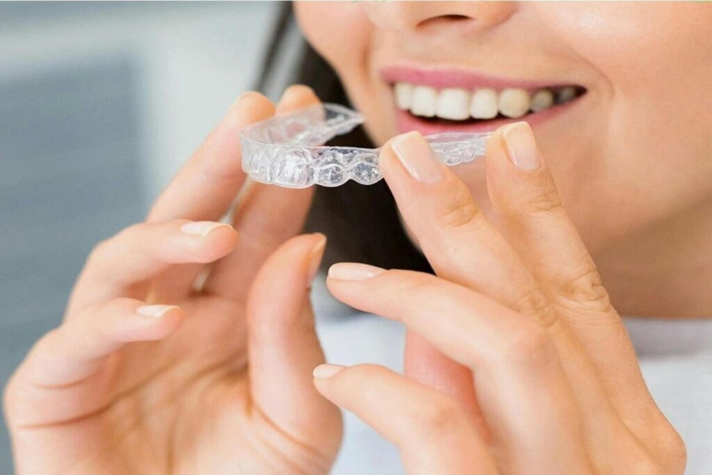 L’alleato trasparente per l’estetica del tuo sorriso