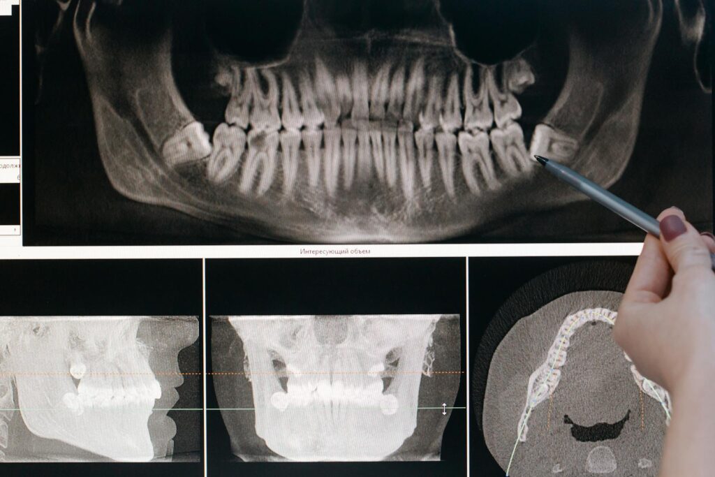 Gnatologia e malocclusione: i campi d’intervento