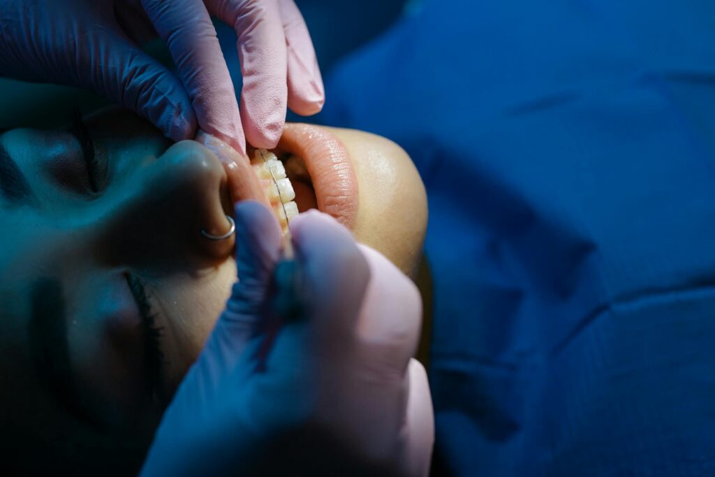 Ortodonzia: l’apparecchio aiuta a curare la parodontite?