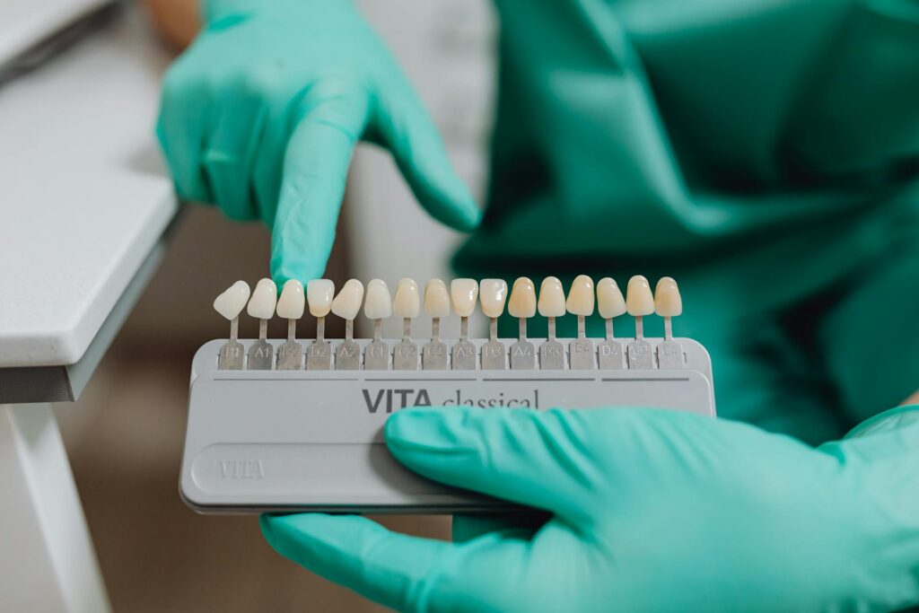 Come funziona il trattamento sbiancante denti per un sorriso perfetto