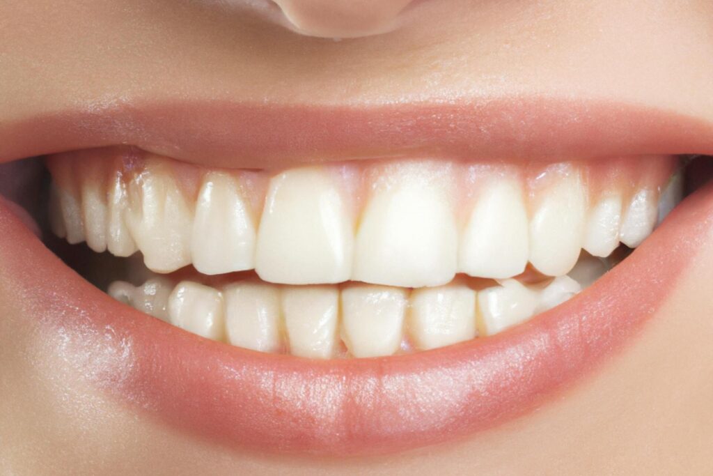 Denti perfetti seguendo poche e semplici indicazioni