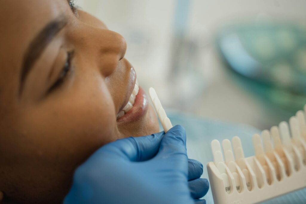 Come funziona lo sbiancamento dei denti con il laser